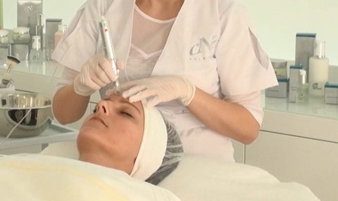 Micro Needling